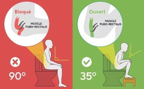 sortir de la constipation - Karine Lepouchard
